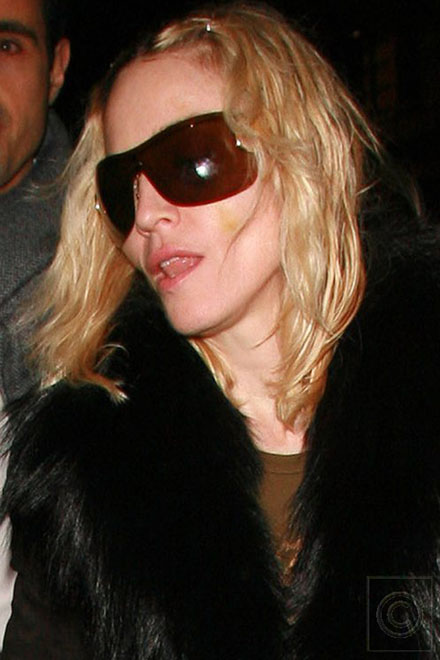 Madonna undergoes more plastic surgery?