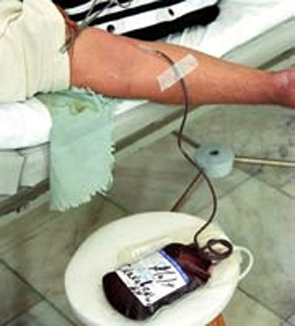 В Азербайджане пройдет акция по сдаче крови для детей, больных талассемией
