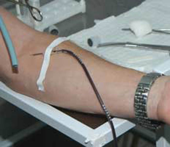 В Азербайджане запасено 14 тонн донорской крови