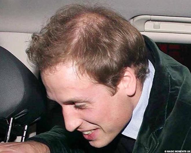 Hair-raising moment as Prince William reveals bald spot