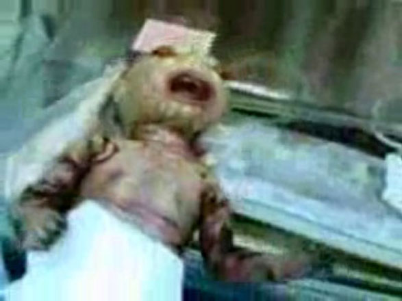 В Саудовской Аравии родился ребенок-змея с глазами наружу (фотосессия)