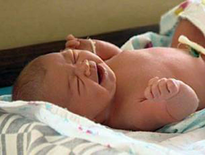 Six-kilo baby born without a caesarean section