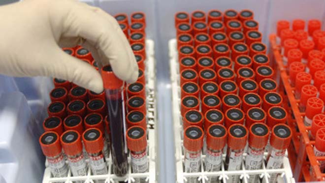 В Азербайджане тест на "свиной грипп" прошли около 900 человек