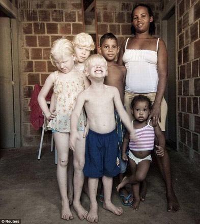 Чернокожая пара родила троих детей-альбиносов (фотосессия)