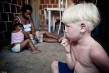 Чернокожая пара родила троих детей-альбиносов (фотосессия)