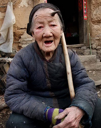 The goat woman: Chinese grandmother, 101, grows mystery horn on forehead