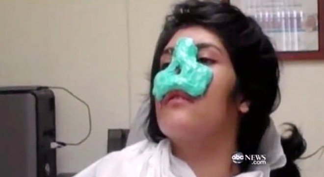 Девушке, которой муж отрезал нос, сделали новое лицо (фотосессия)