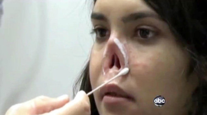Девушке, которой муж отрезал нос, сделали новое лицо (фотосессия)