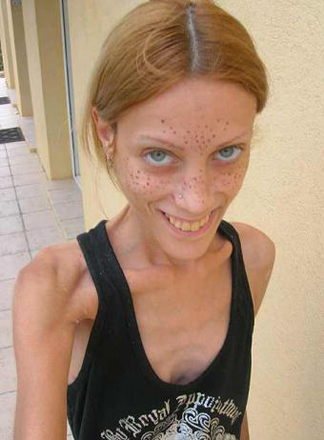 Скончалась французская модель Изабель Кабо, боровшаяся с анорексией (фотосессия)