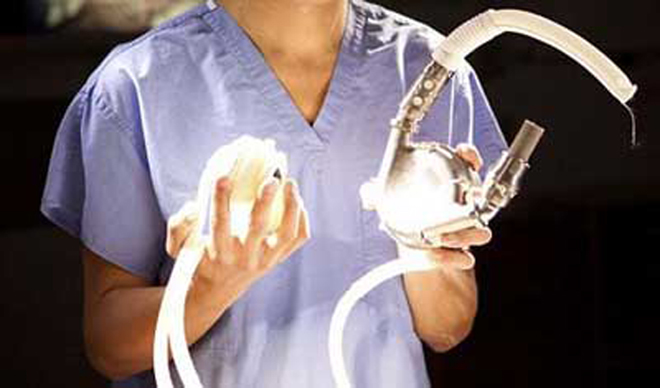 Британские хирурги пересадили человеку сердце на батарейках (фотосессия)