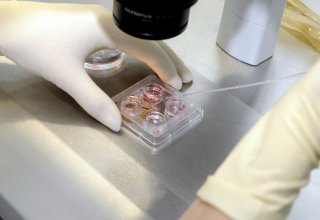 В Таиланде ученые получили антитела для борьбы с болезнью, вызванной вирусом Эбола