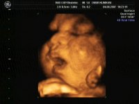 В чем особенность ультразвуковой диагностики 4D при беременности