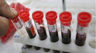 Official: Some 20,000 Iranians suffer from thalassemia