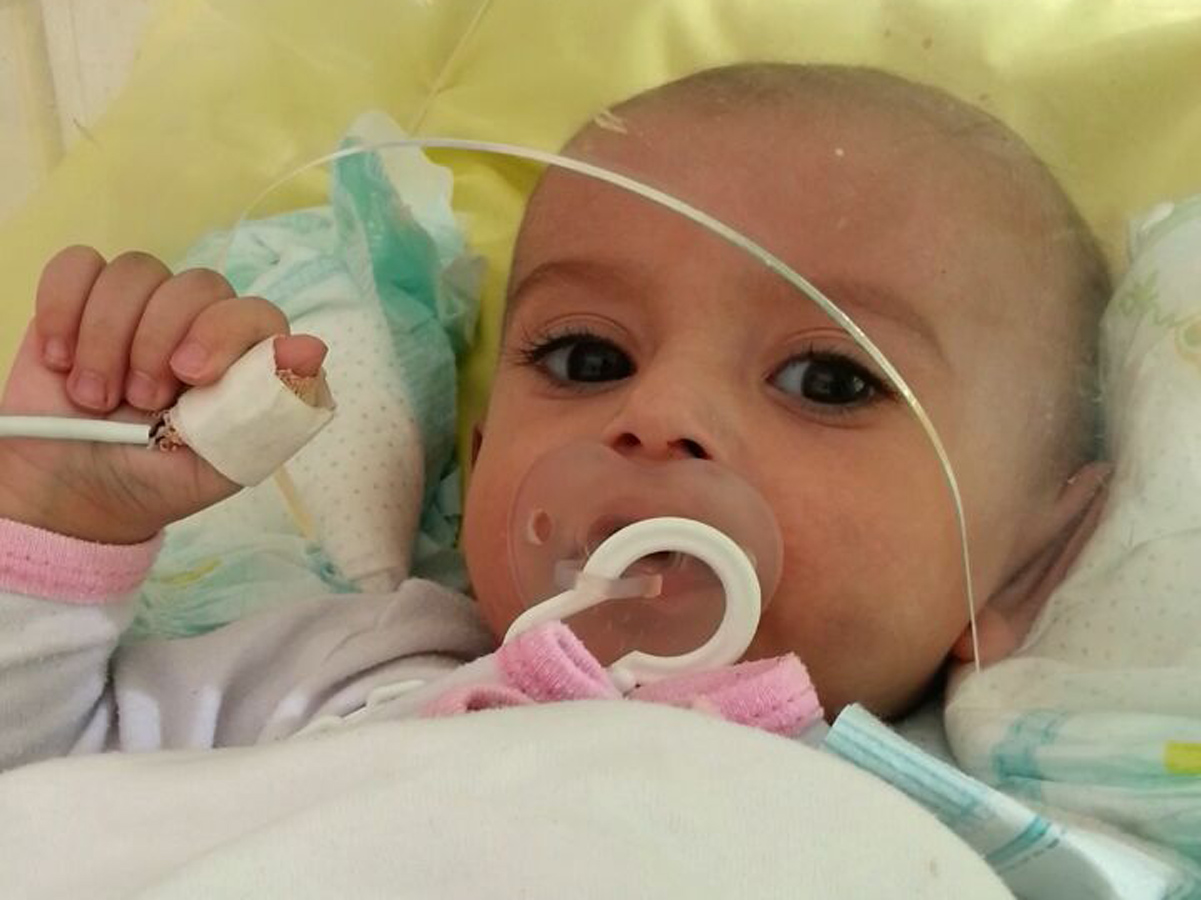 Маленькому Кямалу нужна срочная помощь - спасти жизнь малышу (ФОТО)