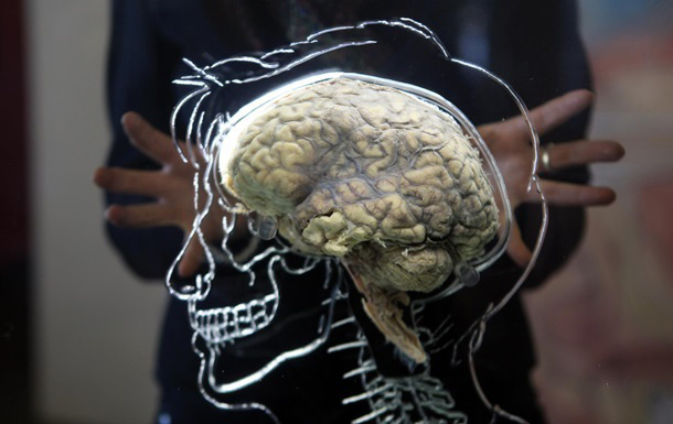 ABŞ alimləri laboratoriyada insan beyni yetişdirdilər