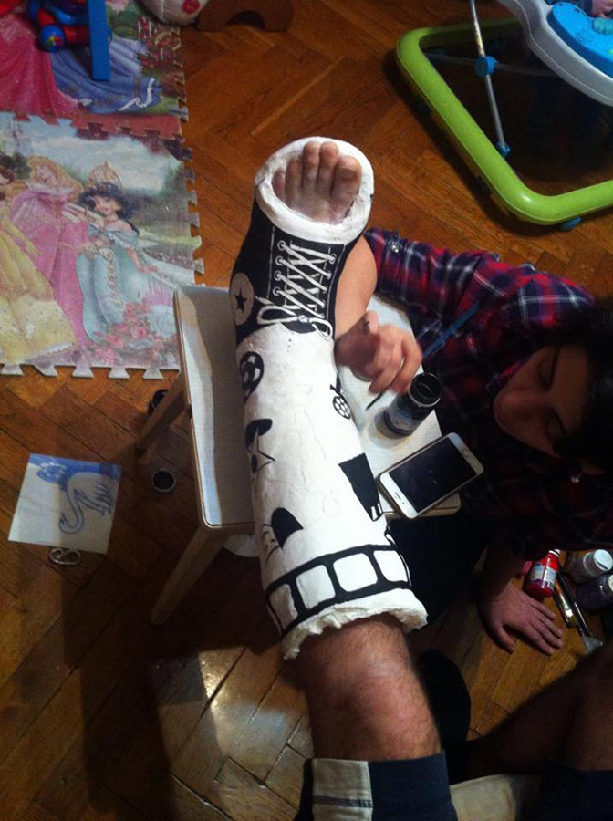 Нога в гипсе Эльнура Керимова стала креативным произведением (ФОТО)
