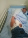 Several Azerbaijani civilians seriously wounded by Armenians (PHOTO)