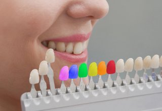 Почему появляется кариес зубов (ФОТО)