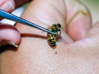 Лечение пчелами – больно, но полезно (ФОТО)
