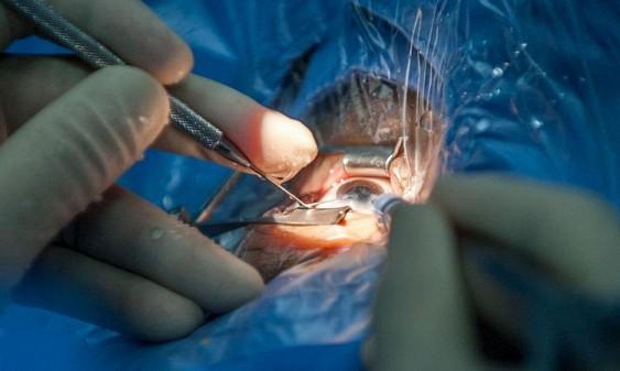 Ученые впервые пересадят ткани сетчатки глаза, выращенные с помощью стволовых клеток
