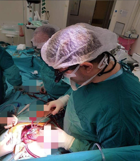В Азербайджане впервые проведена уникальная операция на сердце (ФОТО) - Gallery Image