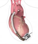 В Азербайджане впервые проведена уникальная операция на сердце (ФОТО) - Gallery Thumbnail