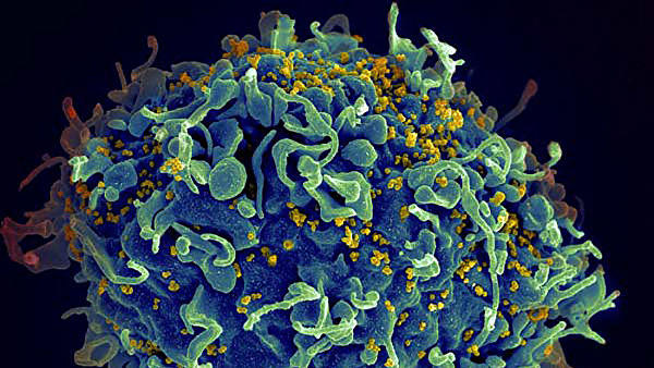 Генетики создали молекулу, очищающую организм от "спящего" ВИЧ