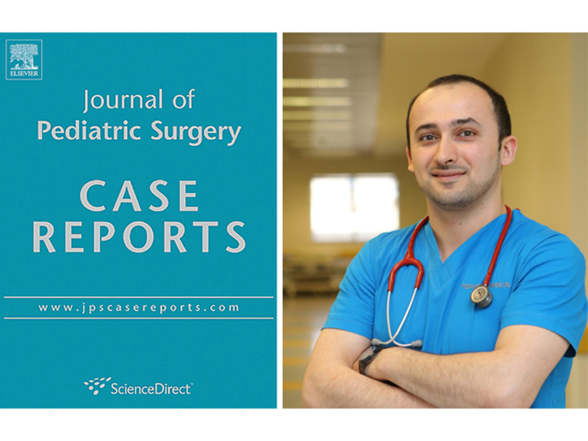 Mərkəzi Gömrük Hospitalının uşaq cərrahının elmi məqaləsi ABŞ-da nüfuzlu “Journal of Pediatric Surgery Case Report” jurnalında işıqlanıb