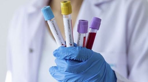 Власти США одобрили новые тесты на иммунитет от коронавируса