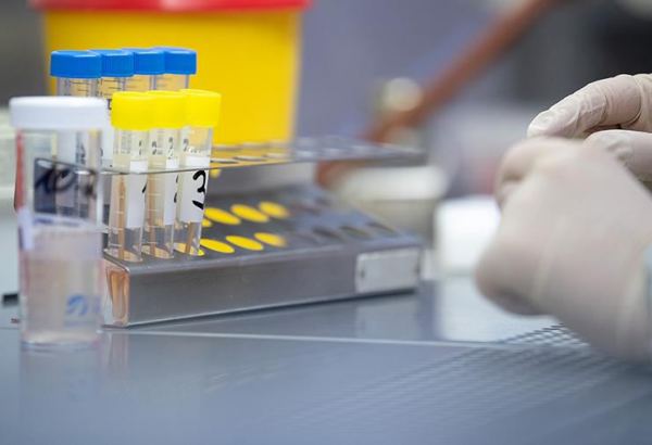 В Чехии начинается всеобщее добровольное тестирование на коронавирус