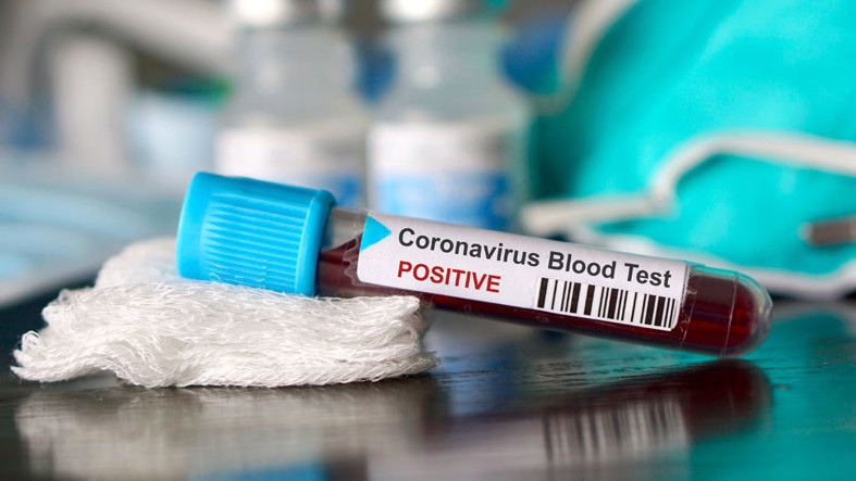 Количество инфицированных коронавирусом в Грузии продолжает расти