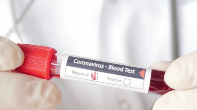 Human trials of Iranian coronavirus vaccine to begin within next 2 weeks