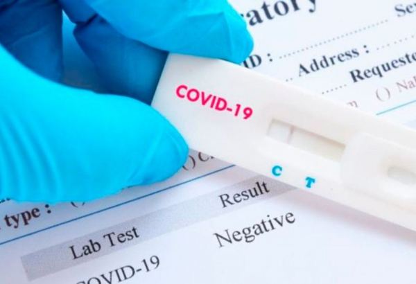Koronavirus xəstələrindən götürülən testin həssaslığı 100 faiz deyil - Nazirlik