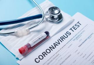 Безлимитное использование тестов может лишить возможности тестирования реальных больных COVİD-19  -  TƏBİB