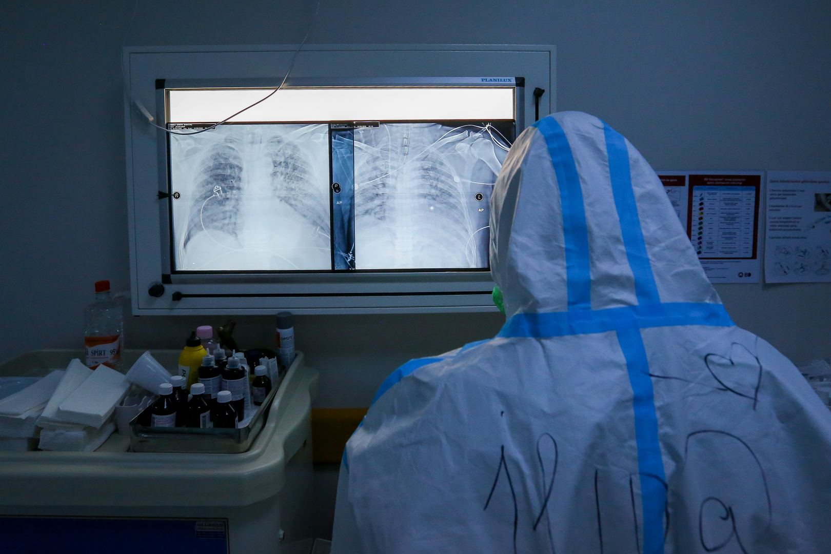 Бойцы невидимого фронта! Азербайджанские врачи, борющиеся с коронавирусом (ФОТО)