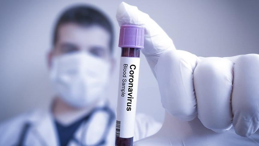 Koronavirusun daha bir simptomu aşkar edilib