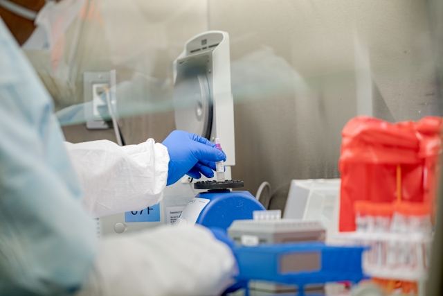 İtaliyada yeni tip ekspres koronavirus testi hazırlanır