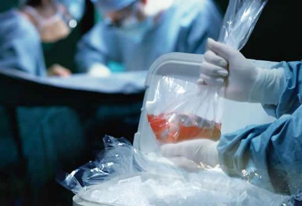 В Азербайджане утвержден реестр человеческих органов и тканей, являющихся объектами трансплантации