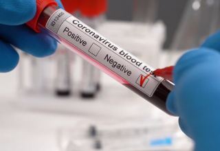 США отменили требование сдавать тест на коронавирус перед въездом в страну