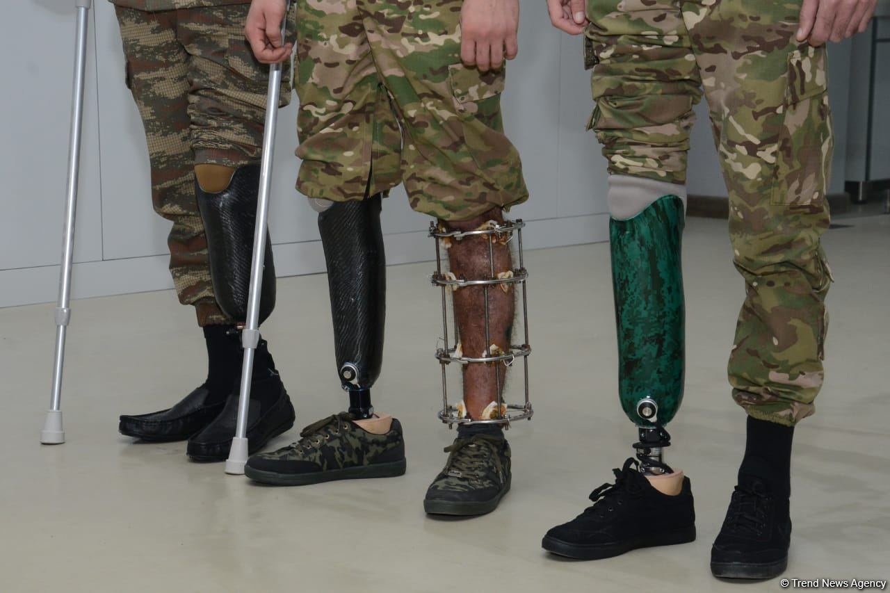 352 hərbçi yüksək texnologiyalı protezlərlə təmin edilib