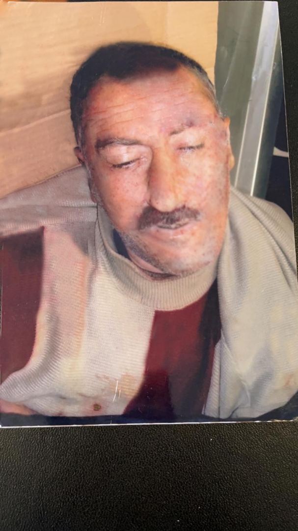 Bakı-Qazax yolunda orta yaşlı kişini maşın vurub öldürdü - FOTO