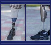 Daha bir qrup qazi yüksək texnologiyalı protezlərlə təmin olundu (FOTO) - Gallery Thumbnail
