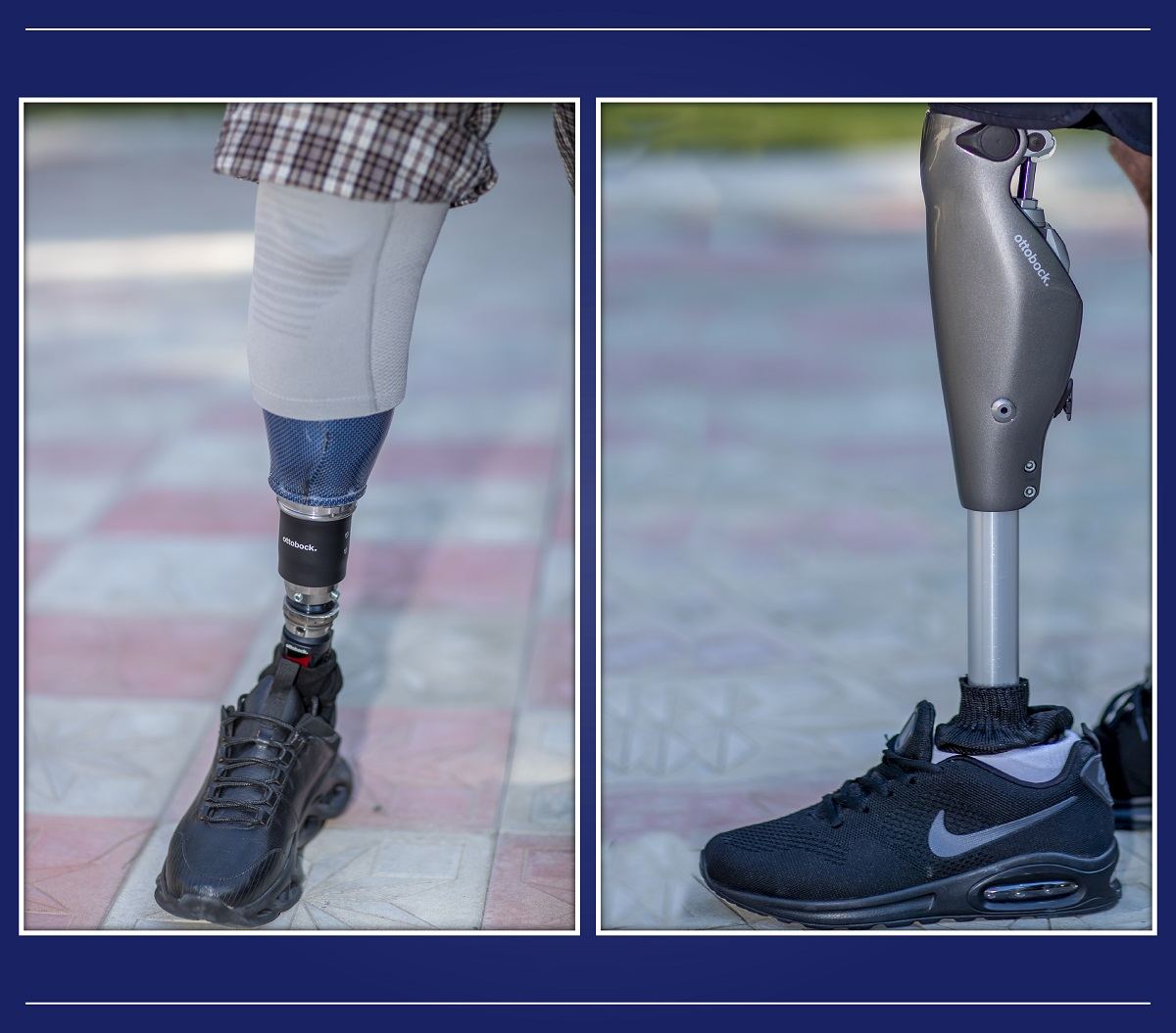 Daha bir qrup qazi yüksək texnologiyalı protezlərlə təmin olundu (FOTO) - Gallery Image