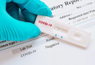 Azerbaijan produces over 20,000 PCR tests for COVID-19
