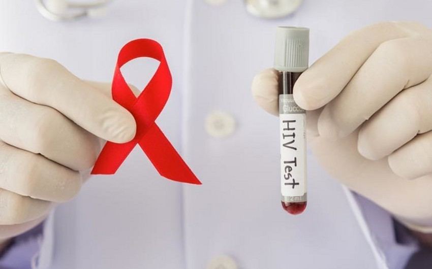 Ситуация с заболеваемостью ВИЧ в Азербайджане находится под контролем