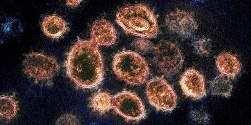 Cənubi Afrika Respublikasında potensial təhlükəli yeni koronavirus aşkar edilib