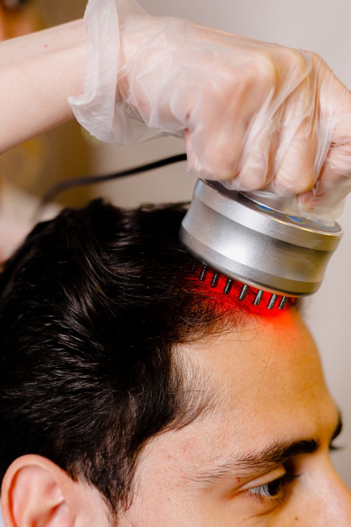 Lazer terapiyası saç tökülməsinə qarşı kömək edə bilər (FOTO)