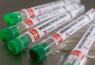 Argentina announces 1st monkeypox death