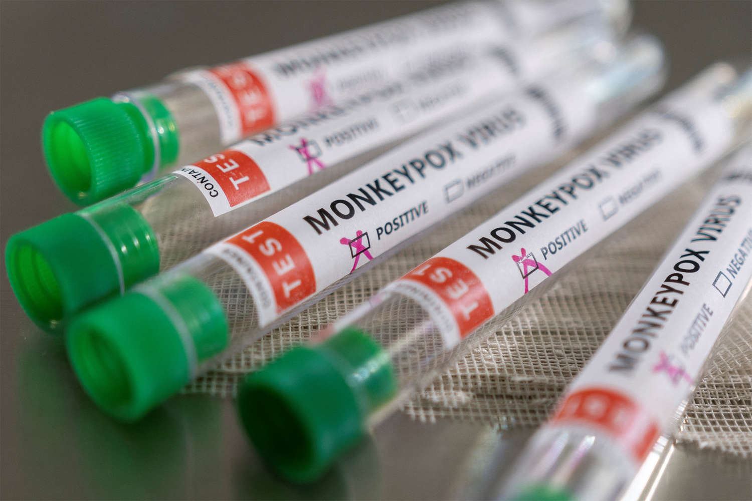 Argentina announces 1st monkeypox death