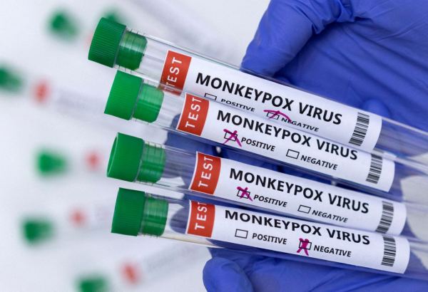 Chile announces 1st monkeypox death
